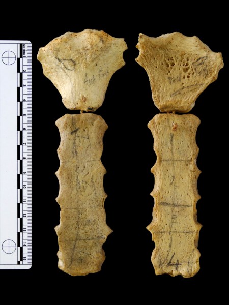 Human sternum Human sternum